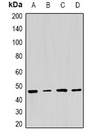 PSMC5 Rabbit Polyclonal Antibody