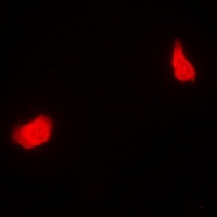 PSMC5 Rabbit Polyclonal Antibody