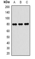 TAP2 Rabbit Polyclonal Antibody