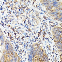 TAP2 Rabbit Polyclonal Antibody