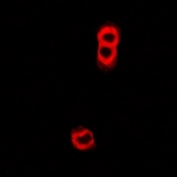 TAP2 Rabbit Polyclonal Antibody