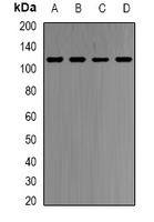 HMGCR Rabbit Polyclonal Antibody