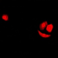 SF2 Rabbit Polyclonal Antibody