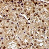 E6AP Rabbit Polyclonal Antibody