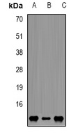 FKBP12 Rabbit Polyclonal Antibody