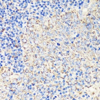 FKBP12 Rabbit Polyclonal Antibody