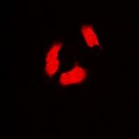 PSMB9 Rabbit Polyclonal Antibody