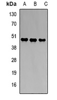 PBGD Rabbit Polyclonal Antibody