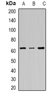 FANCC Rabbit Polyclonal Antibody