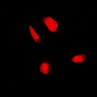 FANCC Rabbit Polyclonal Antibody