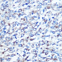 Optineurin Rabbit Polyclonal Antibody