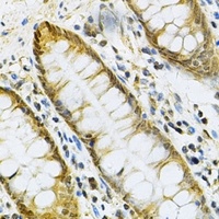 PGK1 Rabbit Polyclonal Antibody