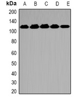 OGT Rabbit Polyclonal Antibody