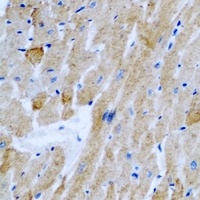 OGT Rabbit Polyclonal Antibody