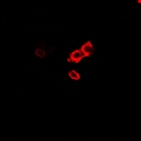 OGT Rabbit Polyclonal Antibody