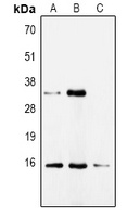 CDA Rabbit Polyclonal Antibody