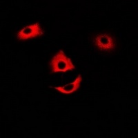 CDA Rabbit Polyclonal Antibody