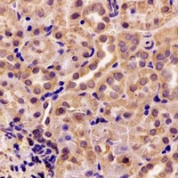 AK4 Rabbit Polyclonal Antibody