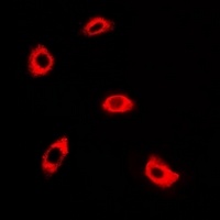 AK4 Rabbit Polyclonal Antibody