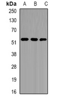 EPHX1 Rabbit Polyclonal Antibody