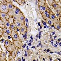EPHX1 Rabbit Polyclonal Antibody