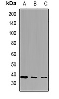 PPA1 Rabbit Polyclonal Antibody