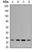 PPX Rabbit Polyclonal Antibody