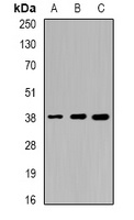 Sorbitol Dehydrogenase Rabbit Polyclonal Antibody