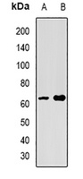 SPAM1 Rabbit Polyclonal Antibody