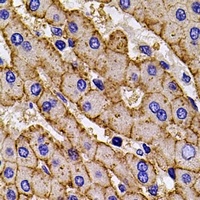 HLA-A Rabbit Polyclonal Antibody