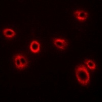 HLA-A Rabbit Polyclonal Antibody