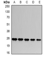 PSMA6 Rabbit Polyclonal Antibody