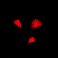 PSMA6 Rabbit Polyclonal Antibody