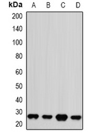 PSMA2 Rabbit Polyclonal Antibody