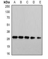 PSMA4 Rabbit Polyclonal Antibody
