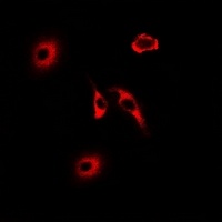 HNMT Rabbit Polyclonal Antibody