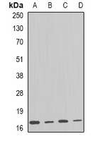 ARF1 Rabbit Polyclonal Antibody