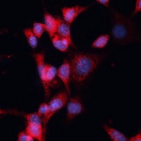 DDB1 Rabbit Polyclonal Antibody