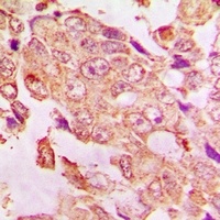 Kv11.1 Rabbit Polyclonal Antibody