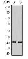 FBXO32 Rabbit Polyclonal Antibody