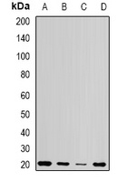 Centrin-1 Rabbit Polyclonal Antibody