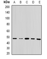 UQCRC2 Rabbit Polyclonal Antibody