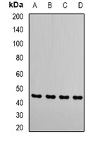 RRM2 Rabbit Polyclonal Antibody
