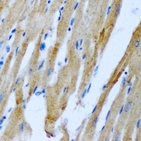 RRM2 Rabbit Polyclonal Antibody