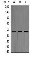 ABAT Rabbit Polyclonal Antibody