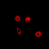 ABAT Rabbit Polyclonal Antibody