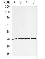 PA28 alpha Rabbit Polyclonal Antibody