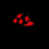 PA28 alpha Rabbit Polyclonal Antibody