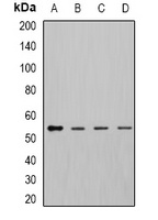DLD Rabbit Polyclonal Antibody
