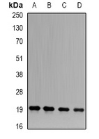 APRT Rabbit Polyclonal Antibody